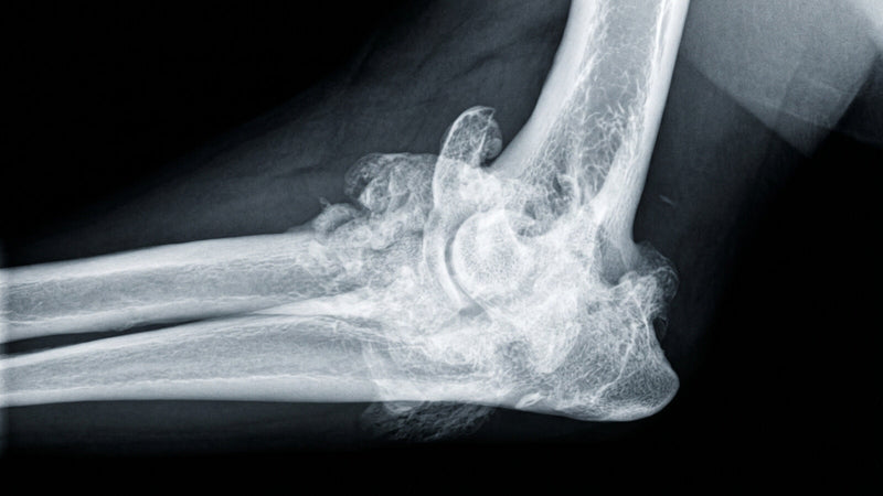 Arthrose beim Hund früh erkennen: 8 Signale, die du nicht ignorieren solltest