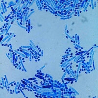 Prä-, Pro- & Postbiotika